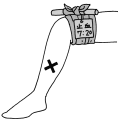 止血帯を巻いた時間を書いておく