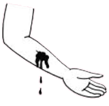 Öo